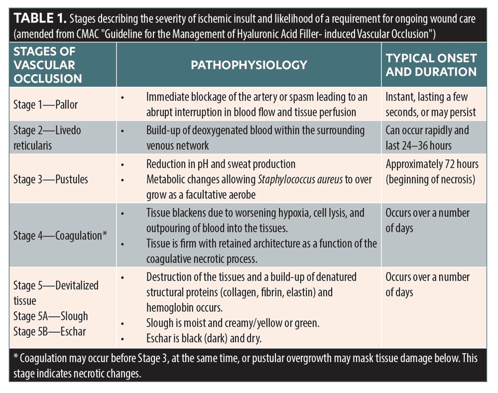 Facial Vascular Events and Tissue Ischemia A Guide to Understanding