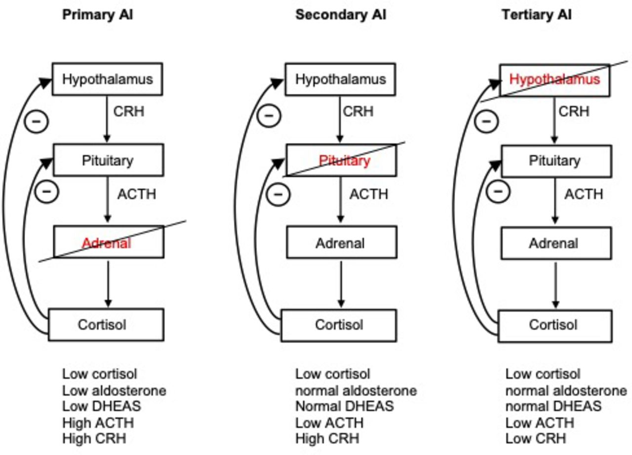 Adrenal insufficiency Journal of Clinical Pathology