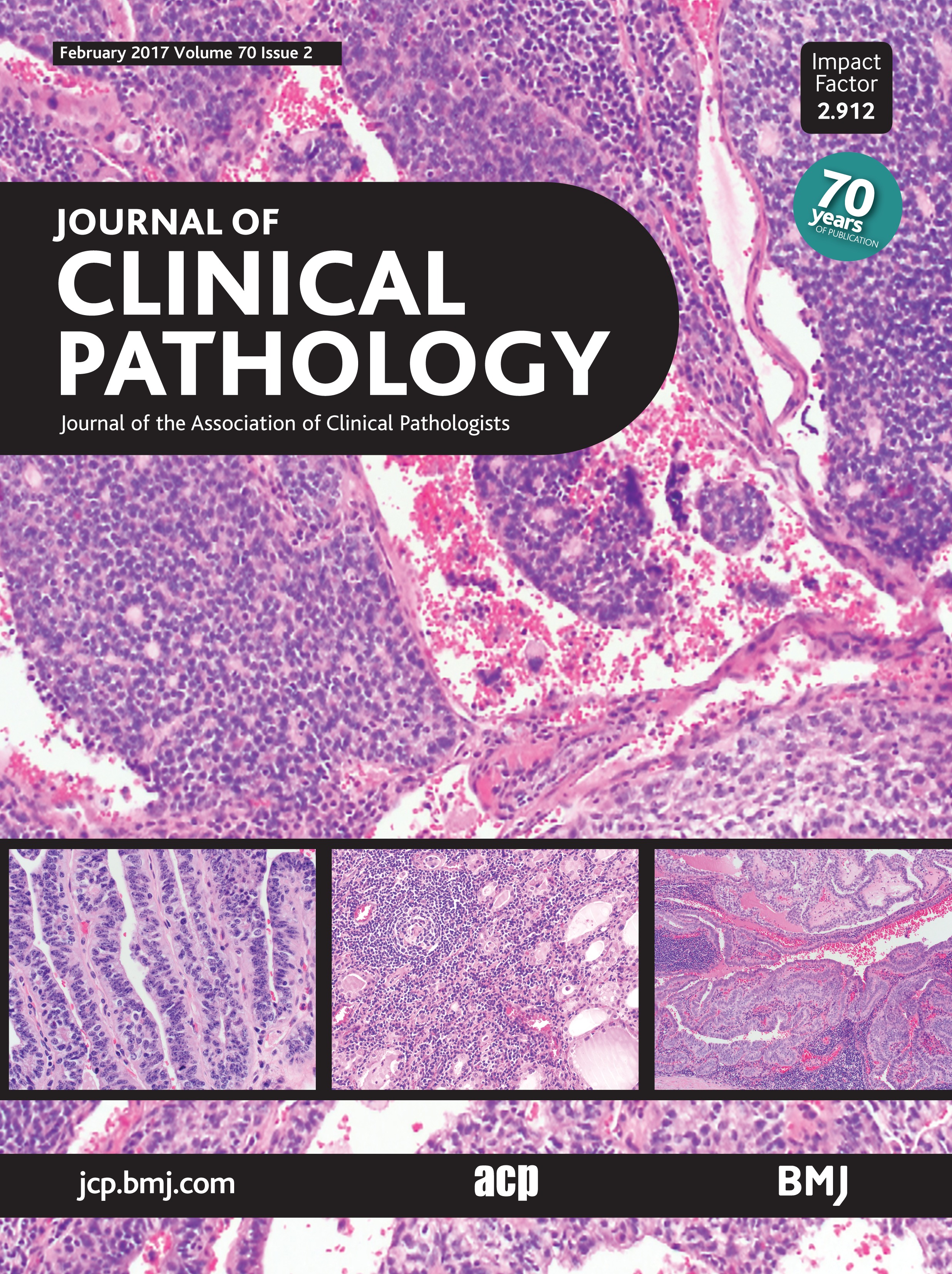 Laboratory assessment of vitamin B12 status Journal of Clinical Pathology