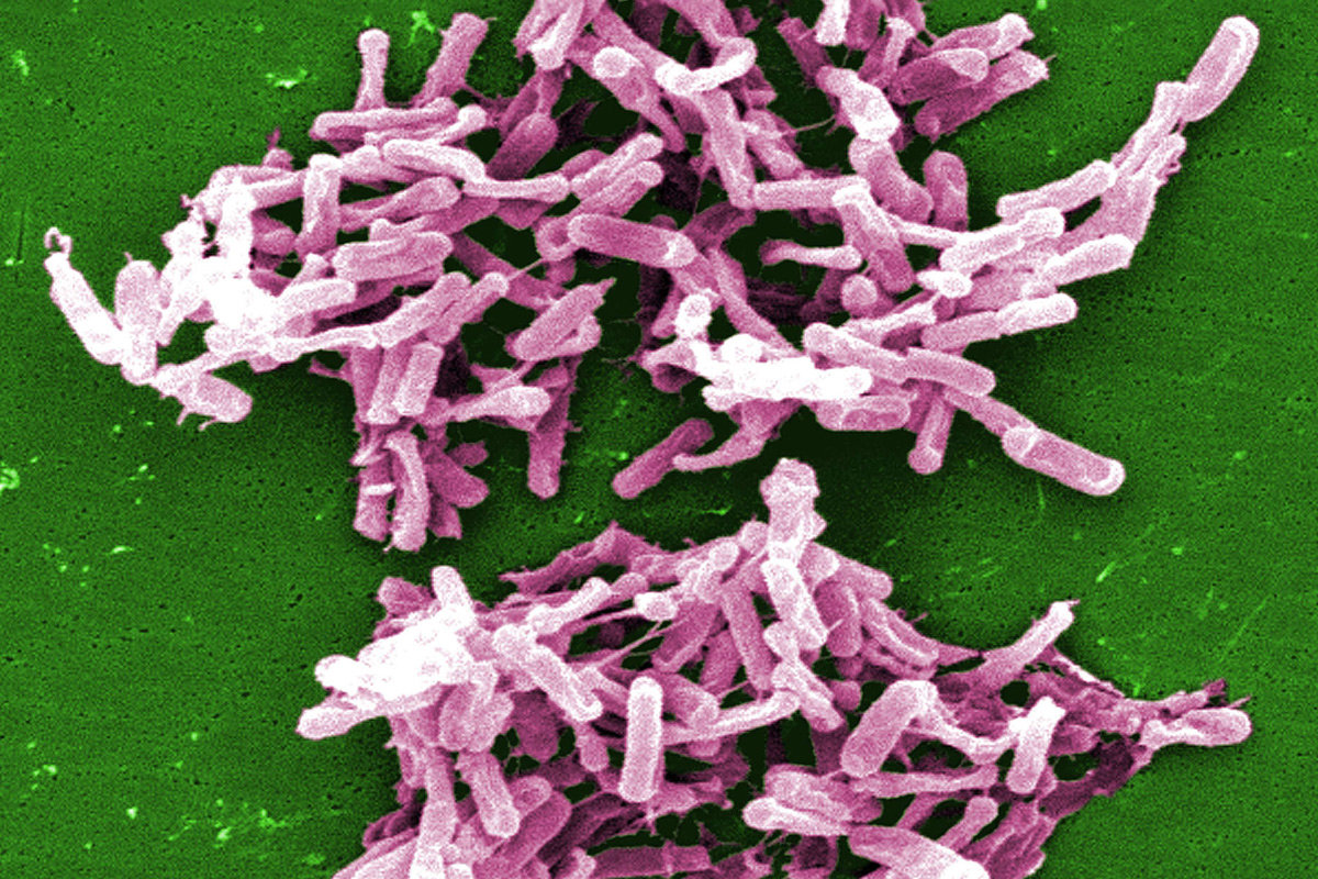 Clostridia Difficile Enterocolitis Causes Prevention and Treatment ...