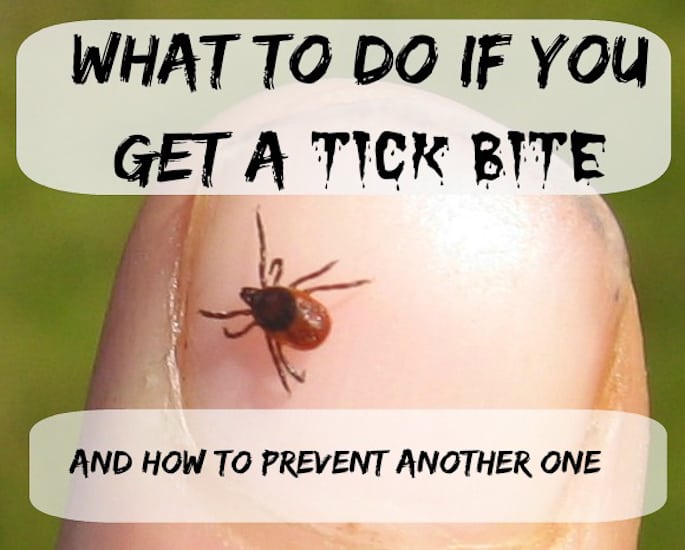 Extracting Ticks and Preventing Tick Bites Jeffrey Sterling, MD