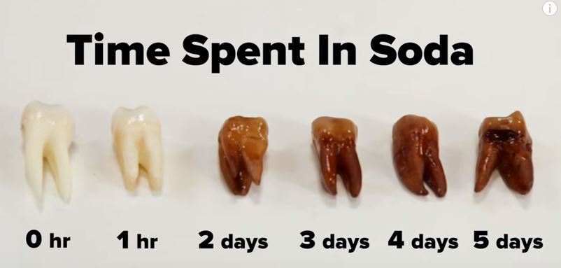 What's your favorite drink doing to your teeth? Jennifer Chiang, DDS
