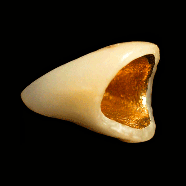 Jensen AZTEC Dental High Noble Yellow Alloy Jensen Dental