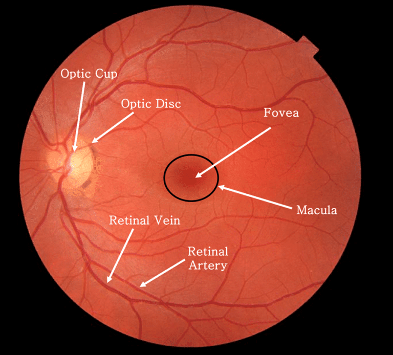How to perform fundoscopy with a direct ophthalmoscope Journal of the