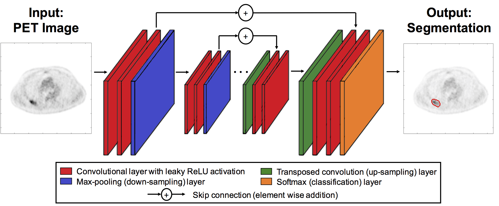 A fully automated modular framework for PET segmentation