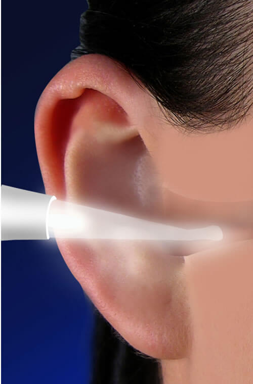 Lighted Ear Wax Remover JL Ryan