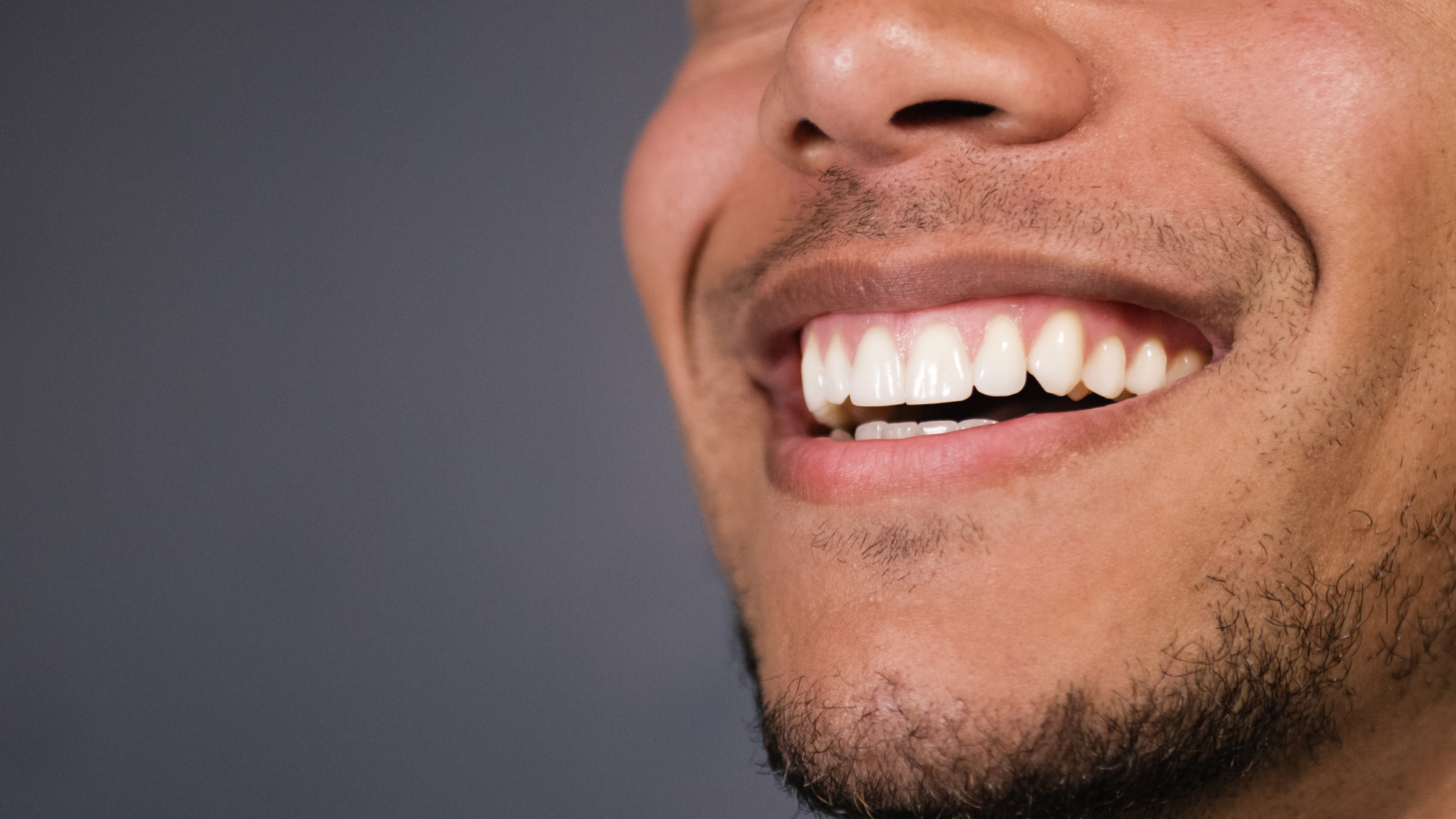 What Are SameDay Dental Implants and Are They Right for You?