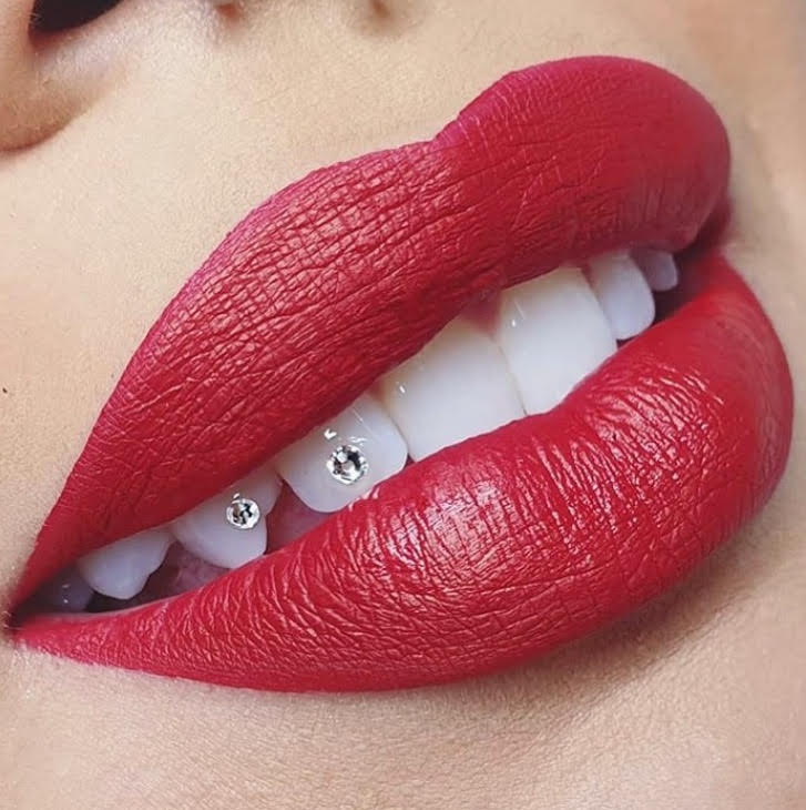 Tooth Bling Vancouver