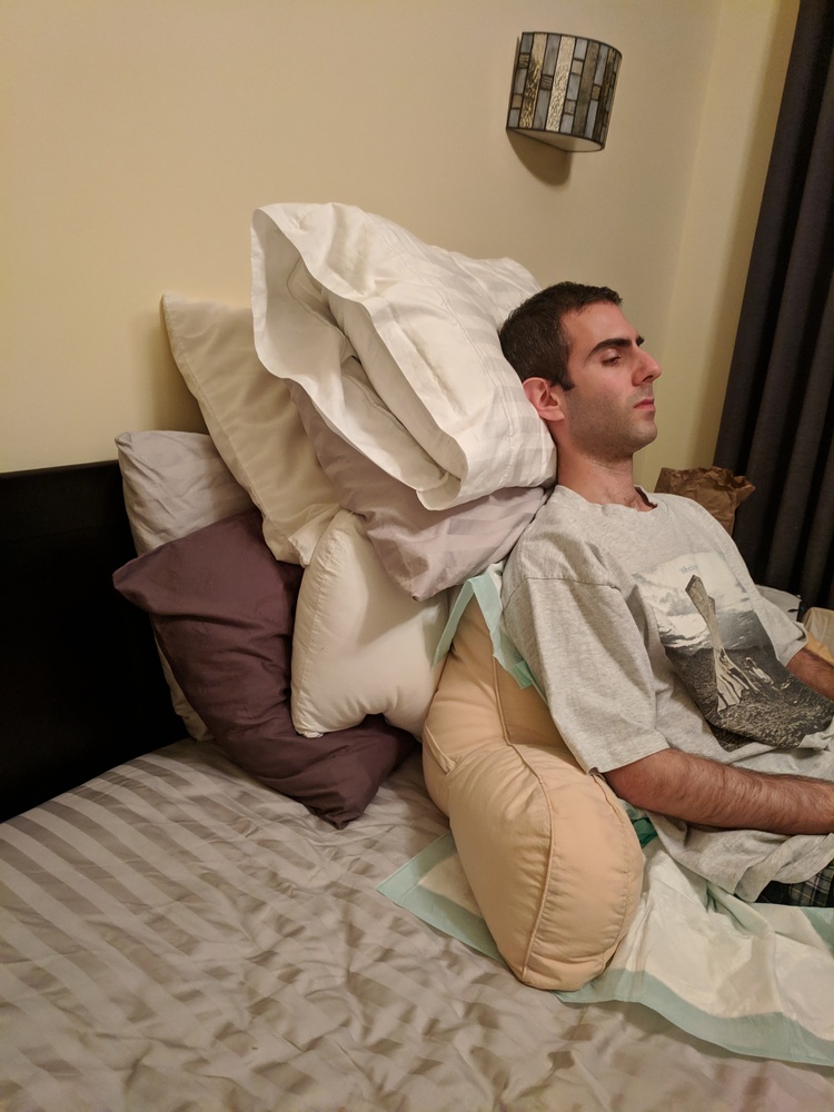 When My Left Lung Collapsed Joe Antognini