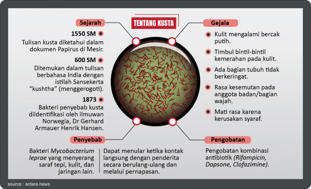 Kusta Di Antara Kita? Waspada, Rangkul, dan Tangani