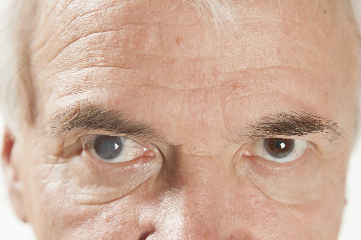 It’s Time for Cataract Surgery When… Dr. John Goosey