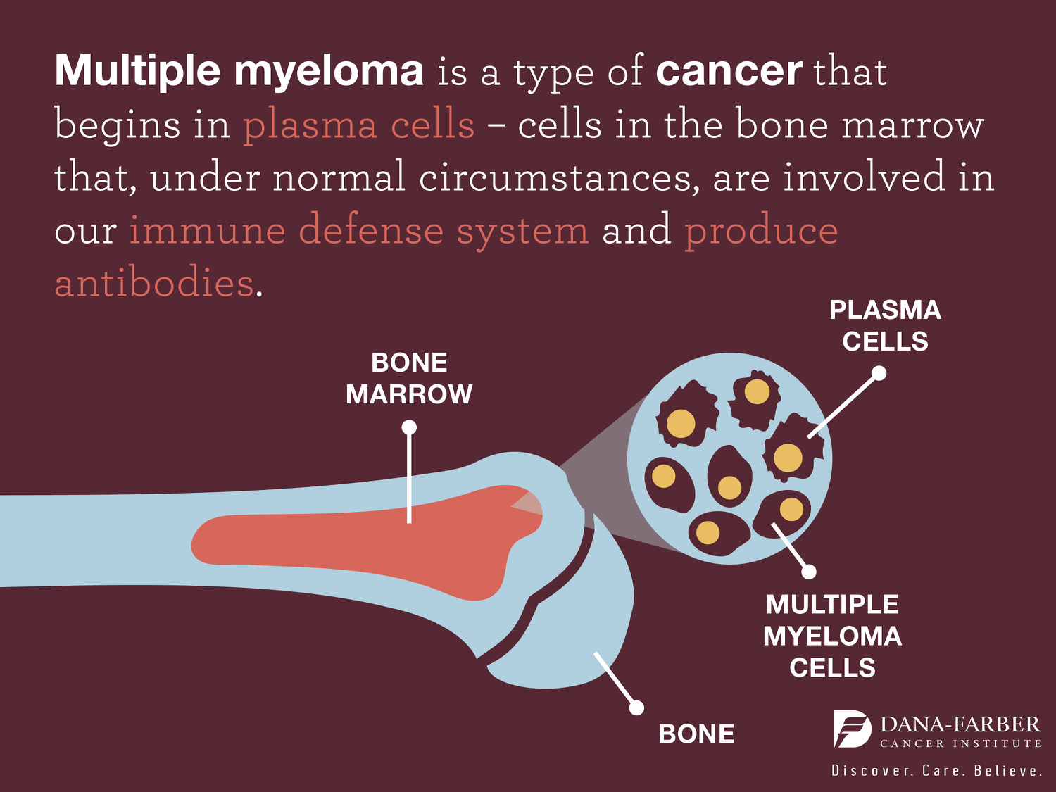 what is multiple myeloma what is multiple myeloma