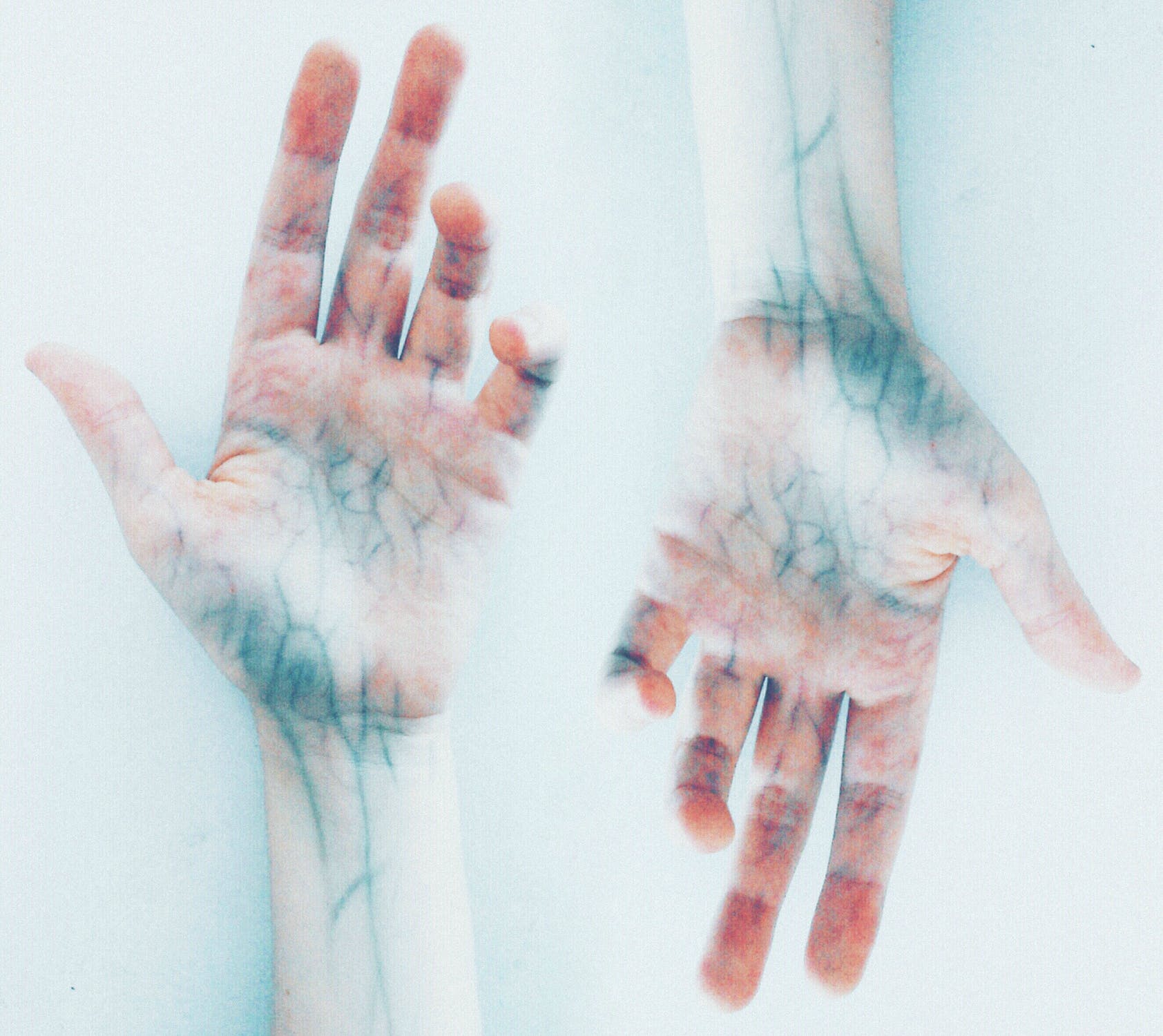 Why Are My Veins Blue? Johnny Holland