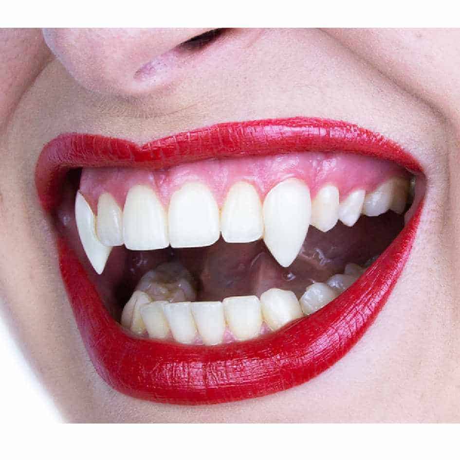 Classic Deluxe Vampire Fangs | www.joke.ie