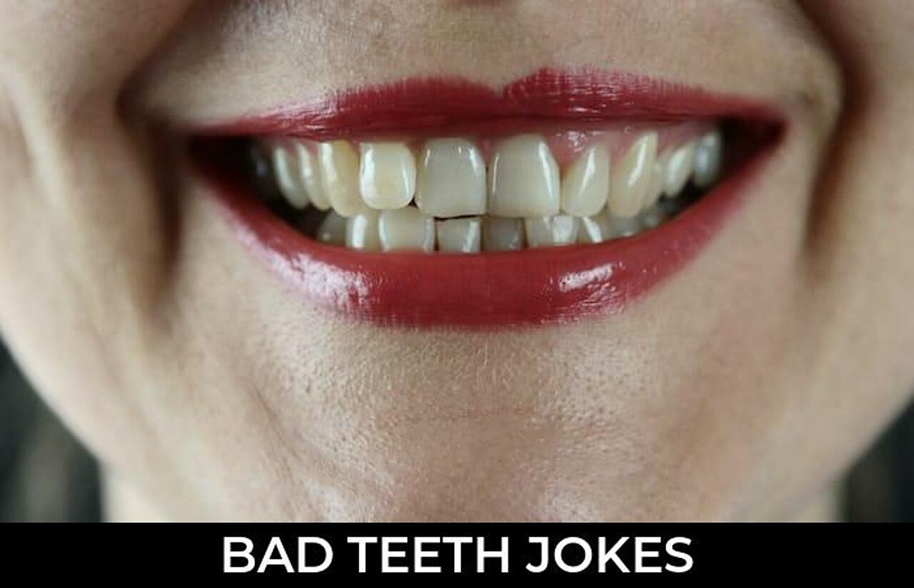 50+ Bad Teeth Jokes And Funny Puns JokoJokes