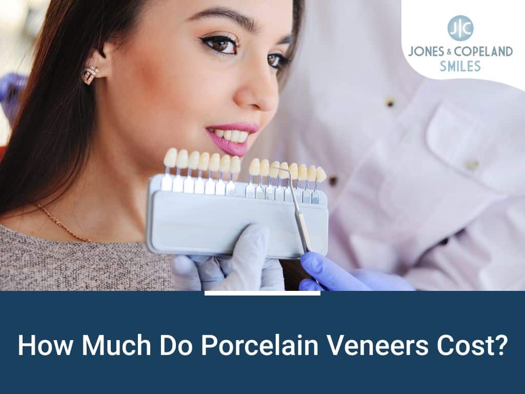 How Much Do Porcelain Veneers Cost? Jones & Copeland Smiles