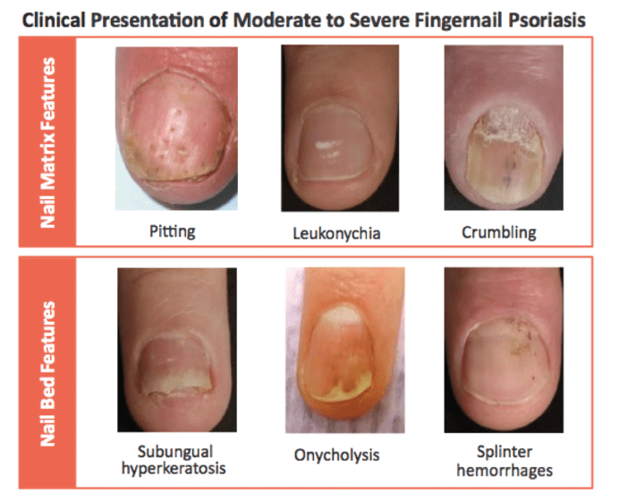 Which skin disease is it? MEDizzy Journal
