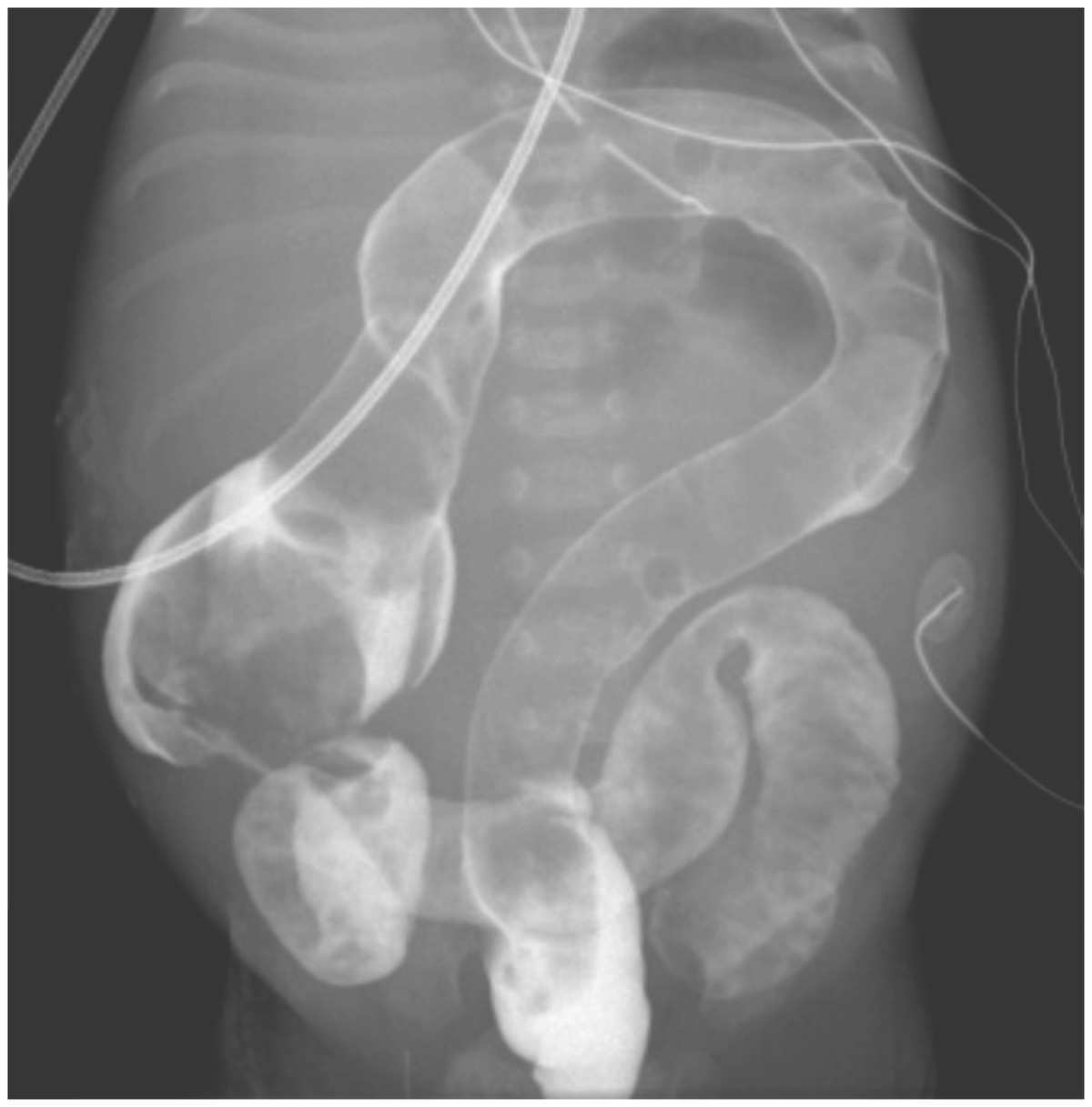 Colon With Question Mark Appearance MEDizzy Journal