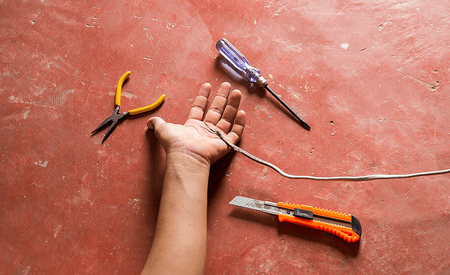 Bilateral Lung Injury In 23YearOld After Electric Shock