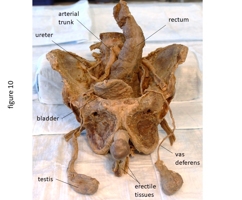 Method for Creating Interactive Plastinated Models of the Male and