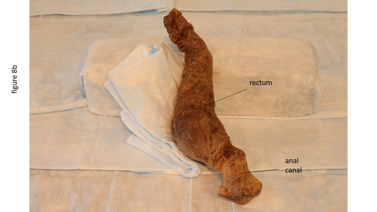 Method for Creating Interactive Plastinated Models of the Male and