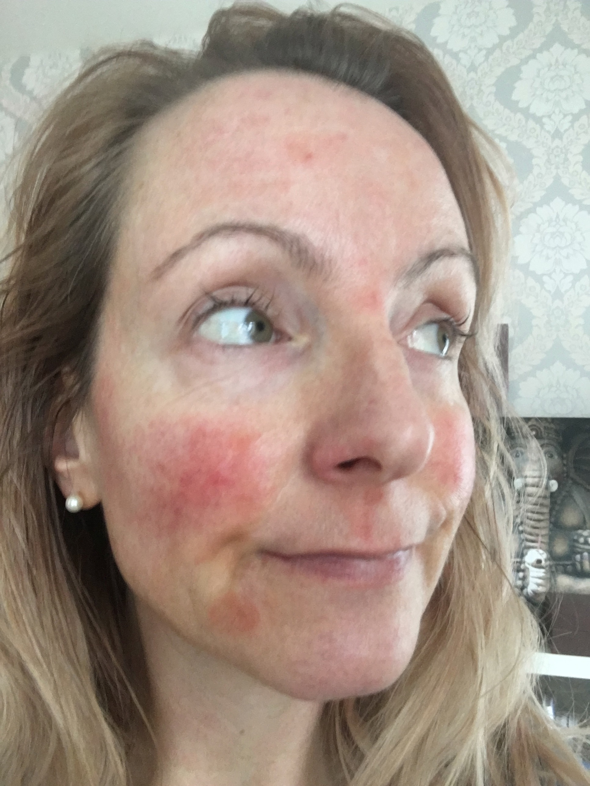 Celery Juice Skin Before And After Rutrend