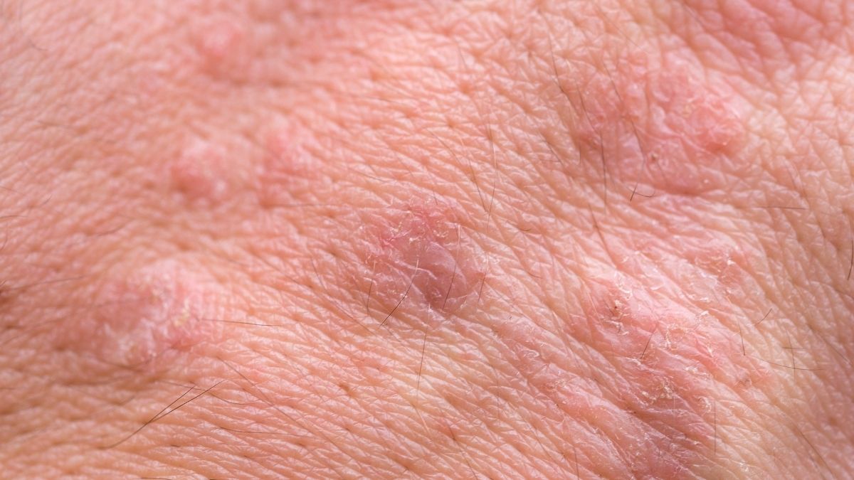 Not Enough Vitamin C Side Effects and Risks