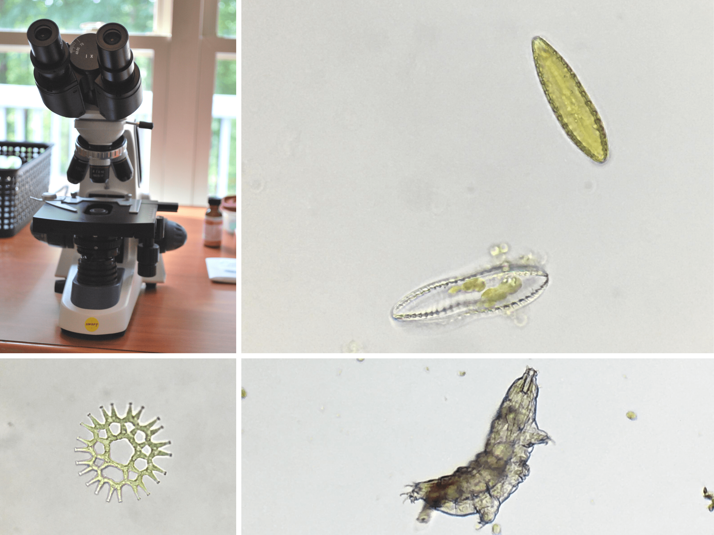 Bacterial Cells Under Microscope 400x(04)