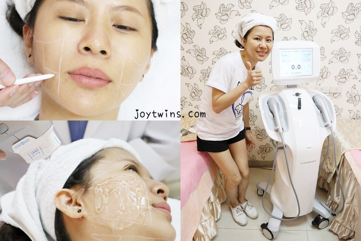 教你怎麼選音波【第三代海芙音波拉提】讓我從媽媽重回小少女