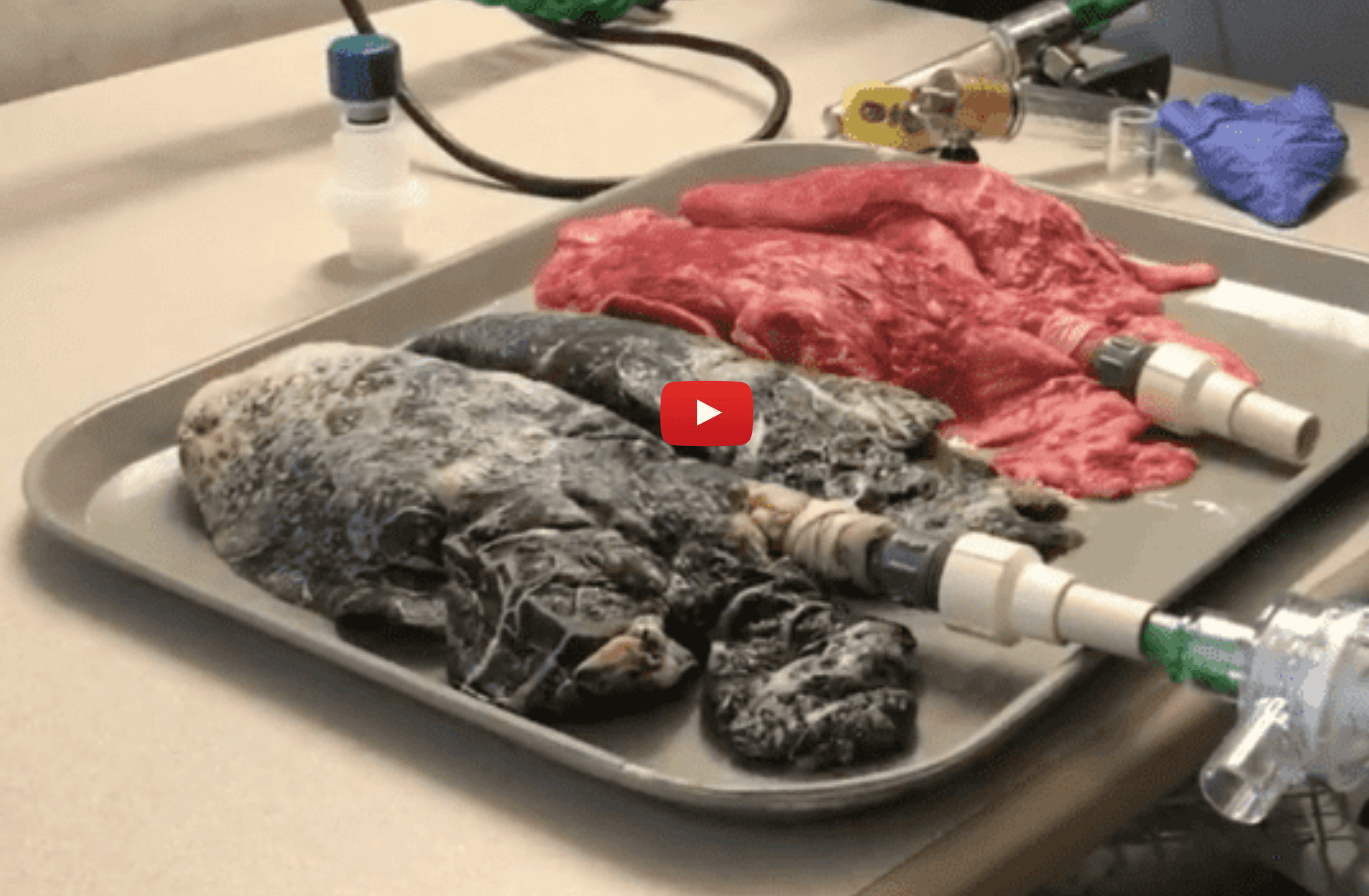 Une infirmière prélève les poumons d'un fumeur et compare
