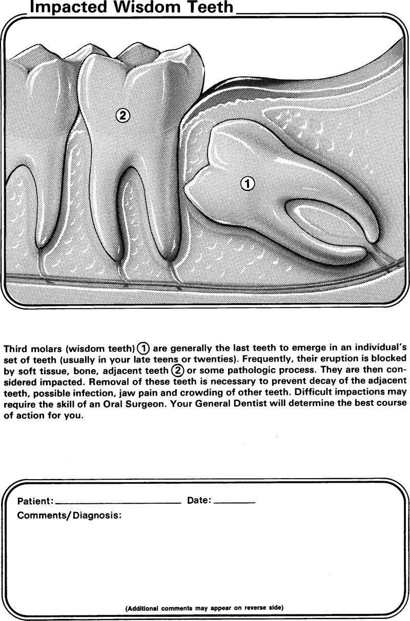 Extractions Hornell, NY Gentle Dentist