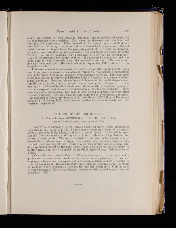 Suture of divided nerves Journal of The Royal Naval Medical Service