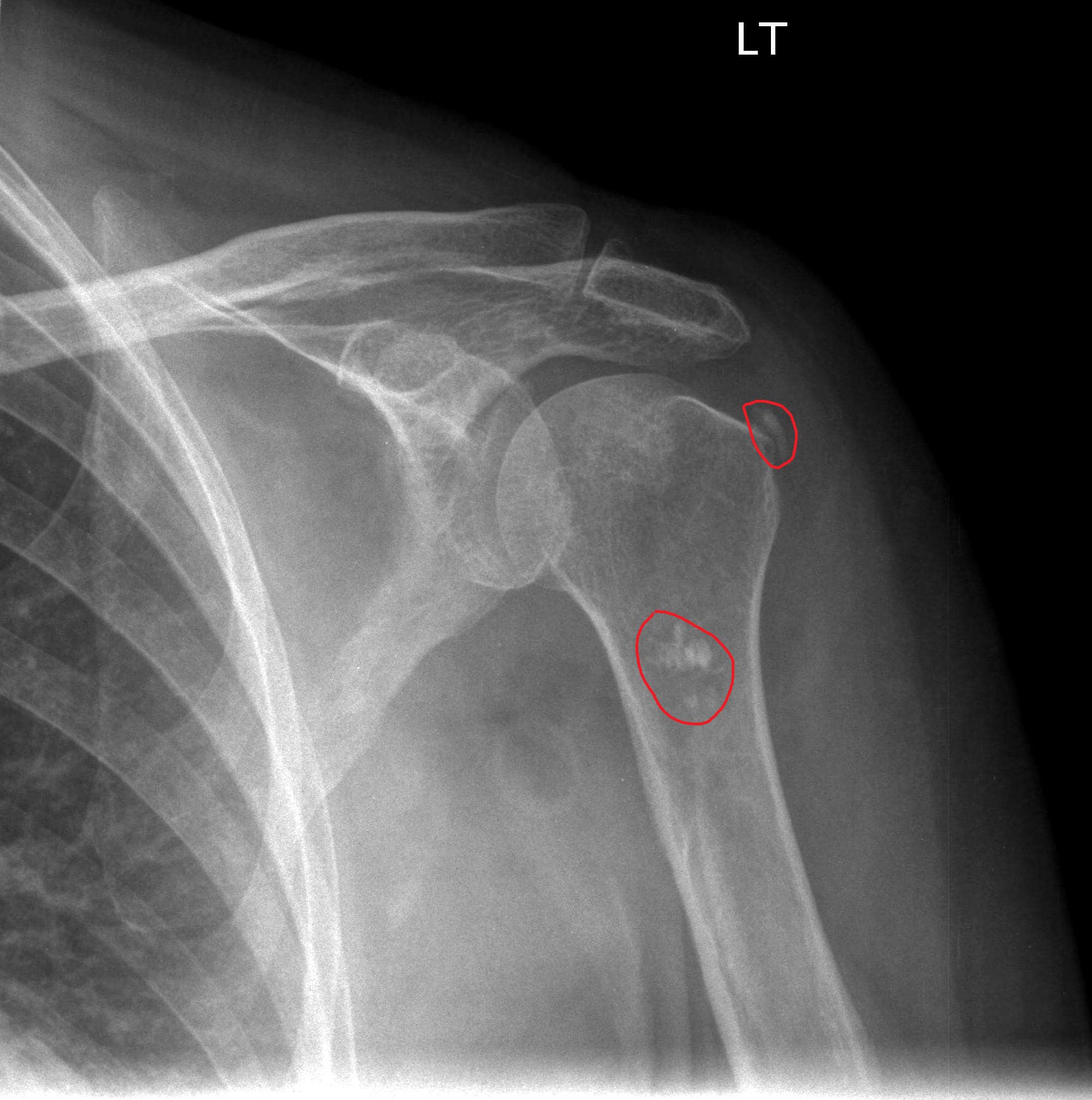 70yearold experiencing shoulder pain Page 2 of 2