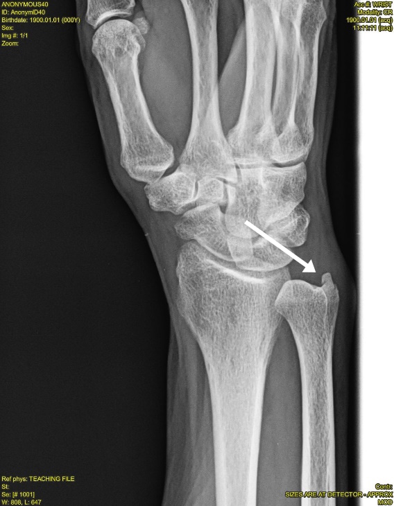 A 51YearOld Man with Wrist Pain After a Fall Page 2 of 2 Journal