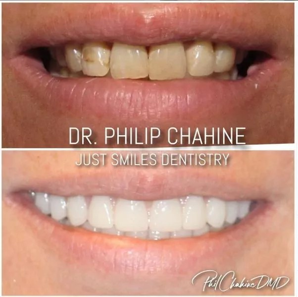 Smile Gallery Columbus OH Dentist Just Smiles General, Cosmetic