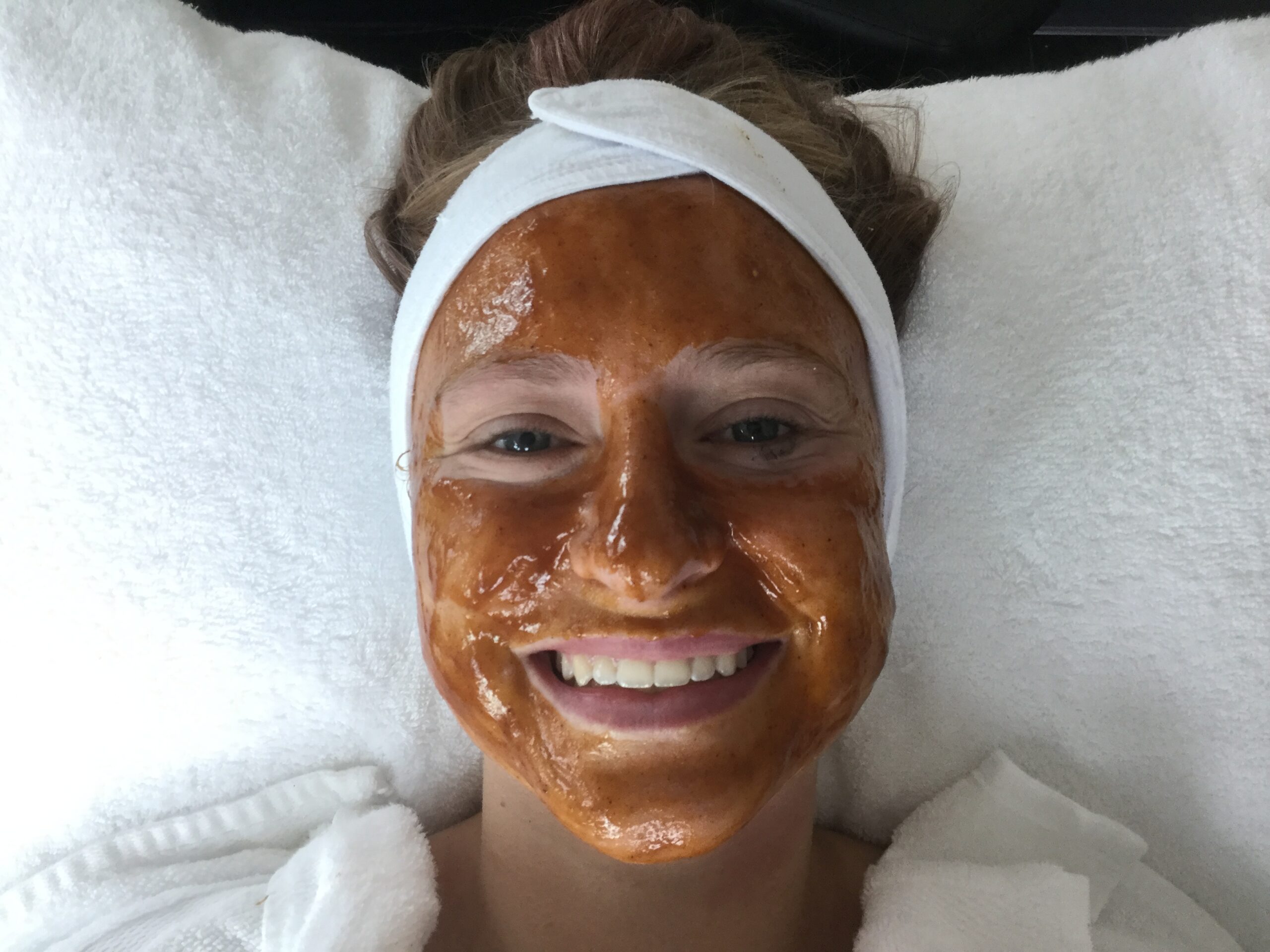 SKIN PEELS JUST ABOUT FACES