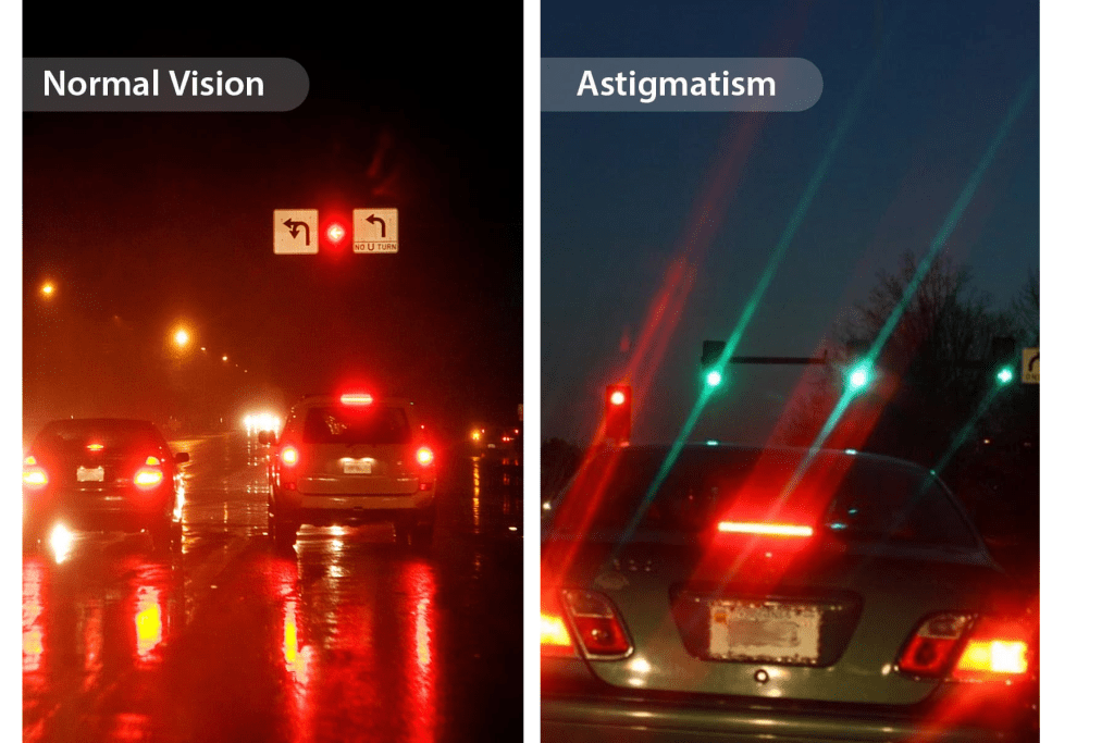 What is Astigmatism and how can it be corrected? All about your
