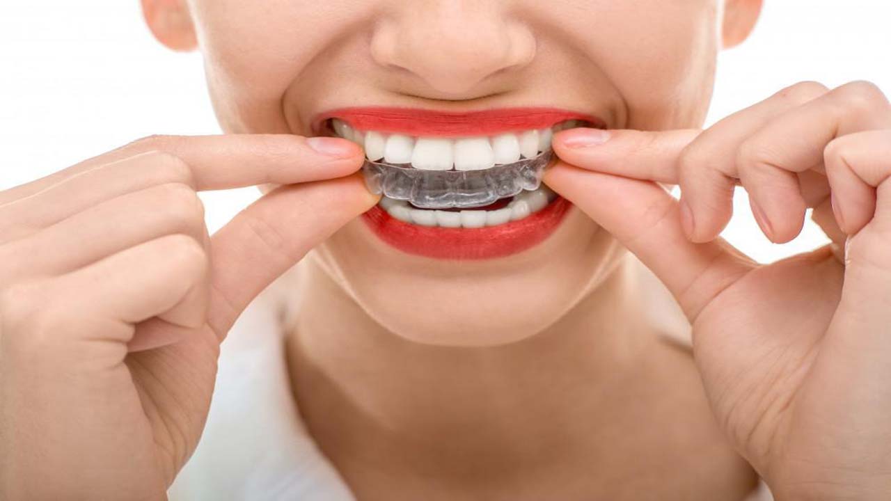 Invisalign Treatments Age Limit Kakar Dental Group