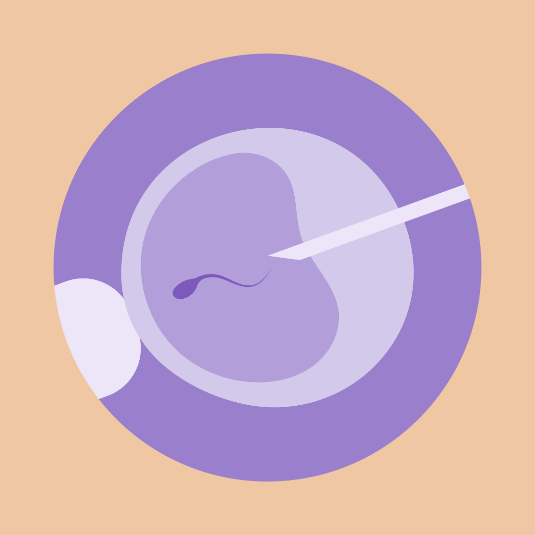 How IVF works Step by step guide to IVF treatment process Dr