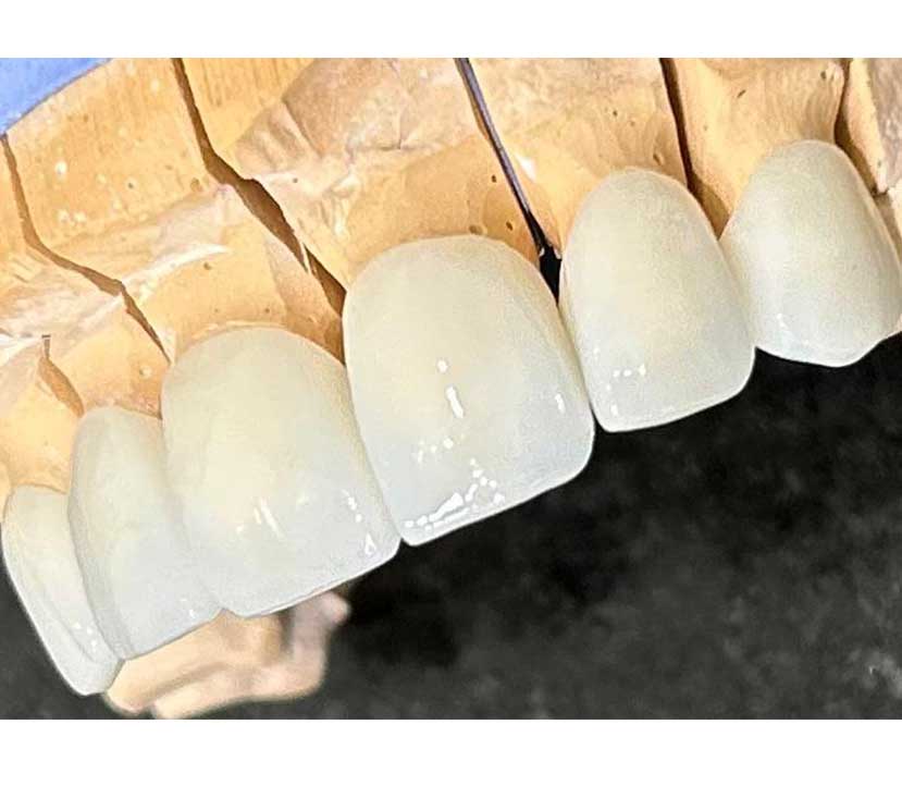 Gallery Kaplan Dental Lab Dubai