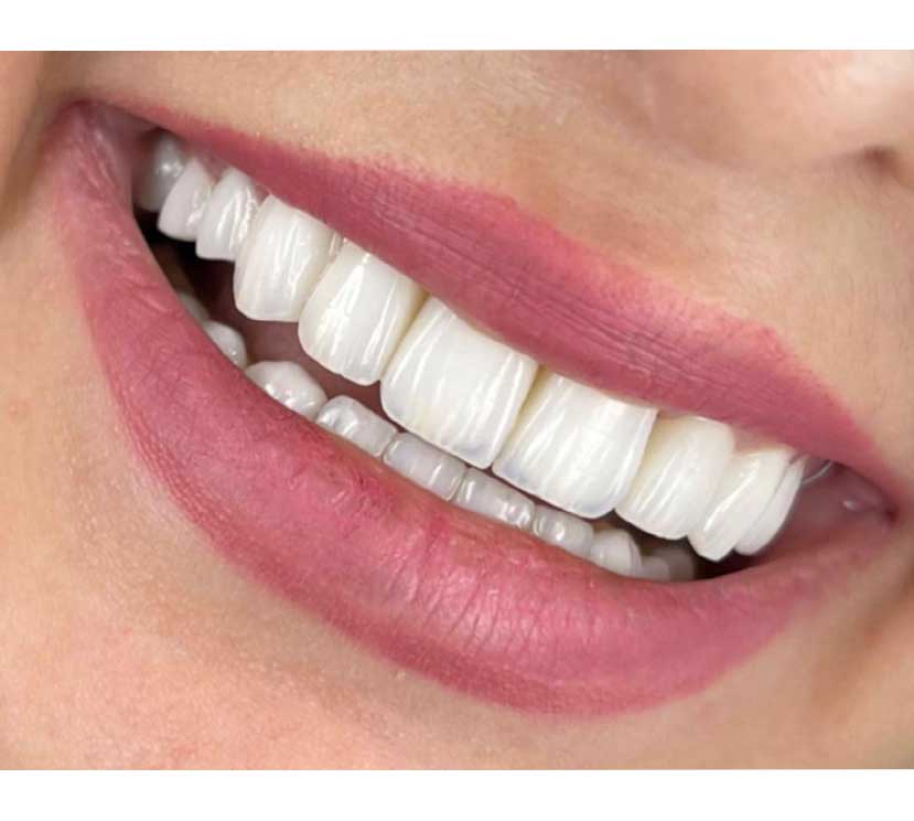 Gallery Kaplan Dental Lab Dubai