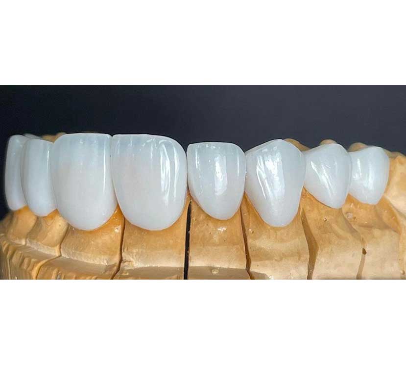 Gallery Kaplan Dental Lab Dubai