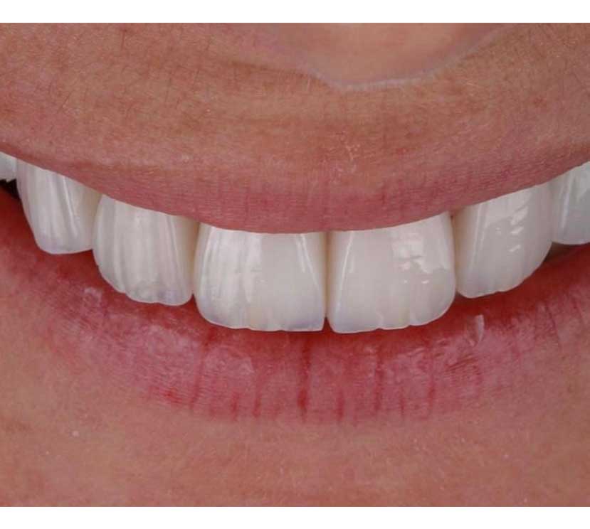 Gallery Kaplan Dental Lab Dubai