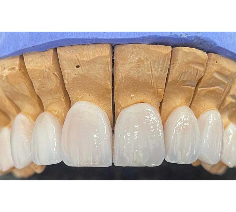 Gallery Kaplan Dental Lab Dubai