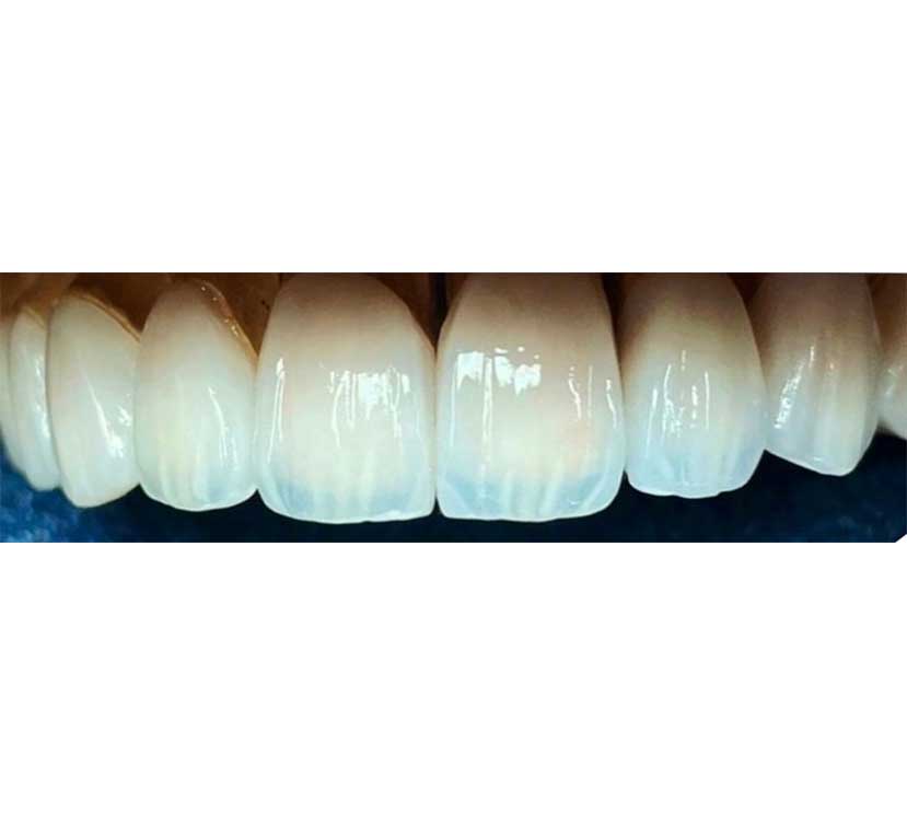 Gallery Kaplan Dental Lab Dubai