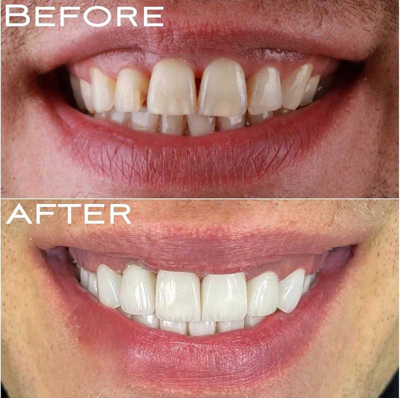 Gallery Kaplan Dental Lab Dubai