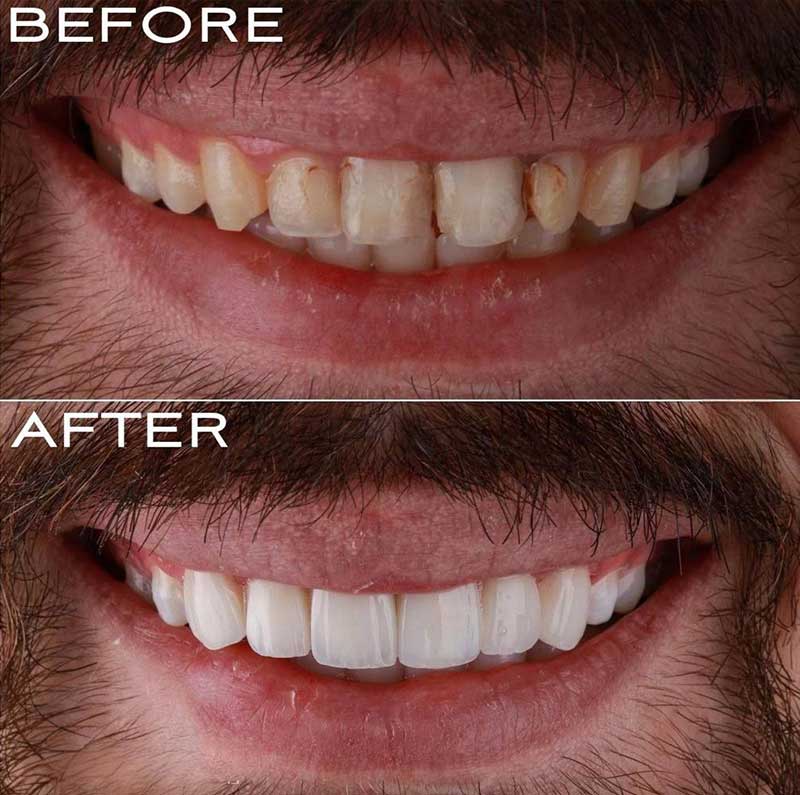 Gallery Kaplan Dental Lab Dubai