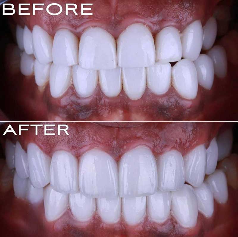 Gallery Kaplan Dental Lab Dubai