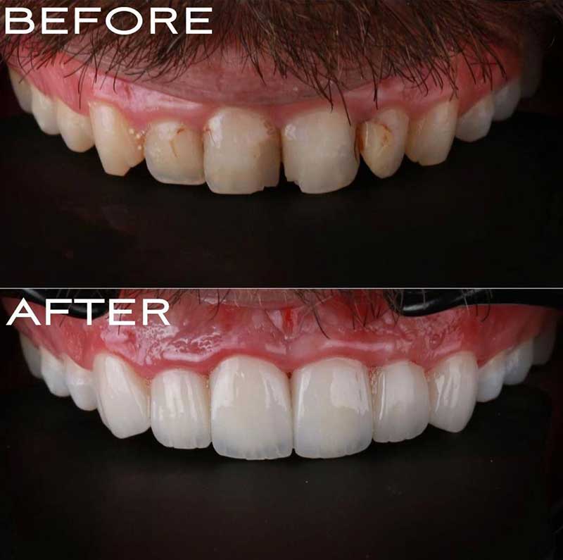 Gallery Kaplan Dental Lab Dubai