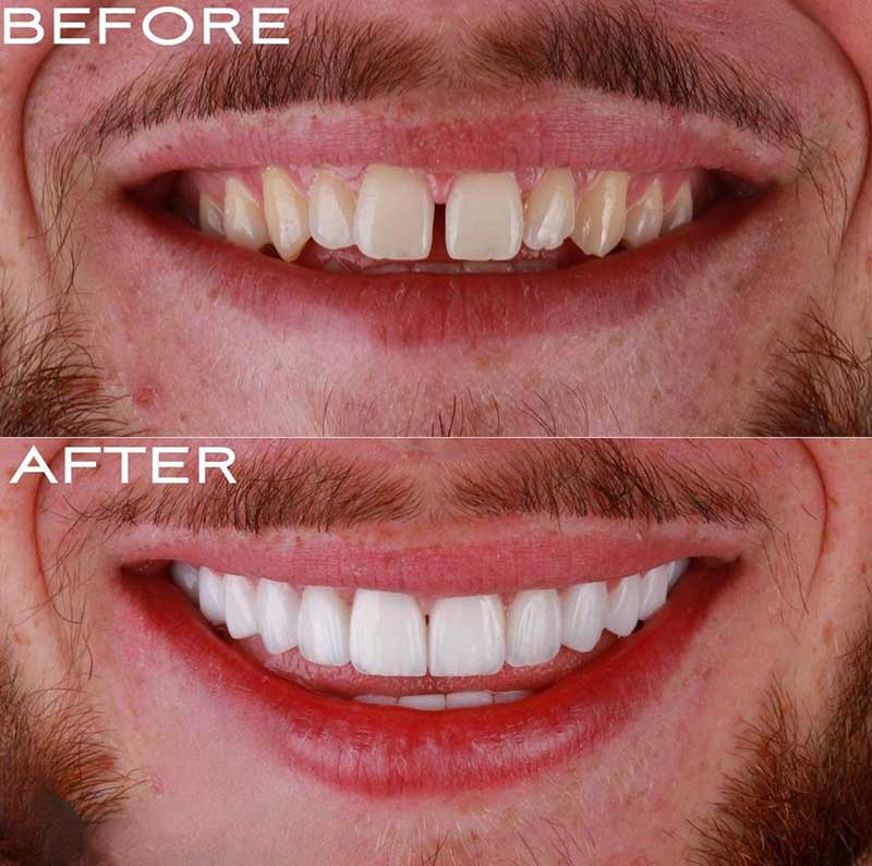 Gallery Kaplan Dental Lab Dubai